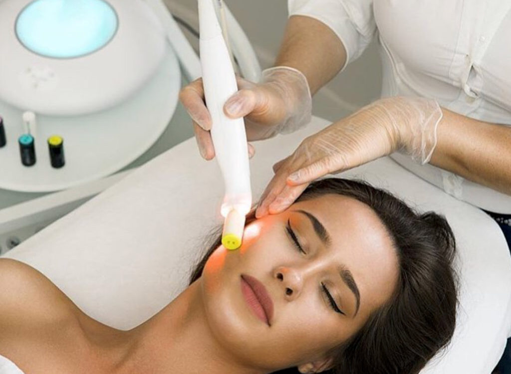 Modeling Bloomea&reg; : Comment faire disparaitre les  cicatrices d’acn&eacute; ? Versailles