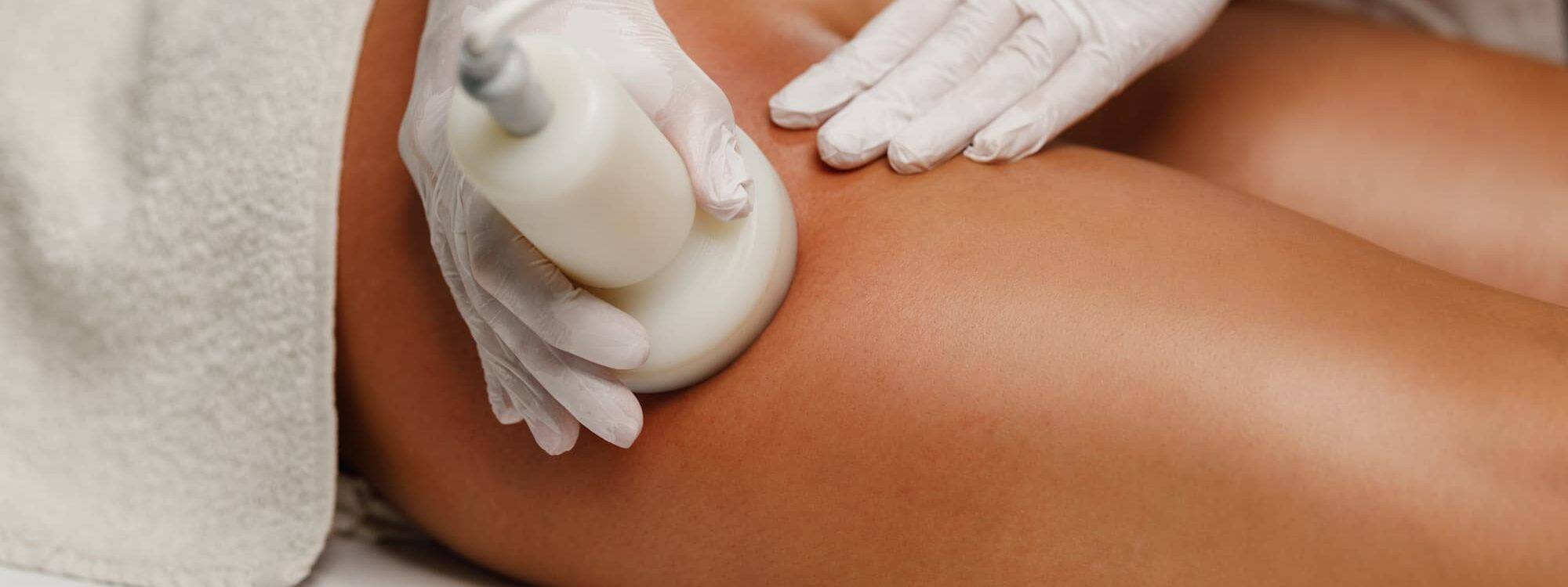 Quels sont les effets de la radiofréquence sur la cellulite ? Nanterre